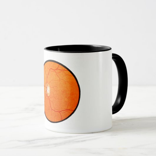 Oftalmologie Optometrie Eye Fundus Exam Mok (Voorkant rechts)