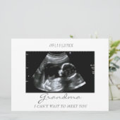 Oma's nieuwe grootbaby echografie aankondiging (Staand voorkant)