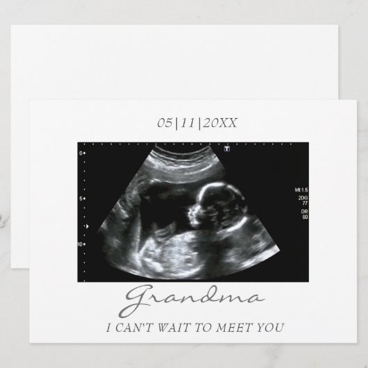 Oma's nieuwe grootbaby echografie aankondiging (Voorkant / Achterkant)