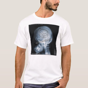 Onderzoek naar hoesje: Roto Tom Player T-shirt