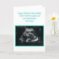 Ongeboren Baby Verwacht vader Vaderdag