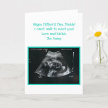 Ongeboren Baby Verwacht vader Vaderdag