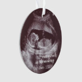 Ons wonder in het maken van ultrasone Sonogram fot Ornament (voorkant)