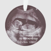 Ons wonder in het maken van ultrasone Sonogram fot Ornament (voorkant)