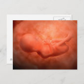 Ontwikkeling van de foetus op 24 weken briefkaart (Voorkant / Achterkant)