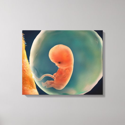 Ontwikkeling van de foetus op 9 weken canvas afdruk (Voorkant)