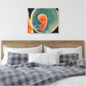Ontwikkeling van de foetus op 9 weken canvas afdruk (Insitu (Slaapkamer))