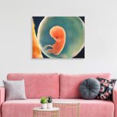 Ontwikkeling van de foetus op 9 weken canvas afdruk (Insitu (Woonkamer))