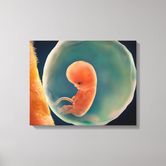Ontwikkeling van de foetus op 9 weken canvas afdruk (Voorkant)