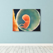 Ontwikkeling van de foetus op 9 weken canvas afdruk (Insitu (Houten vloer))