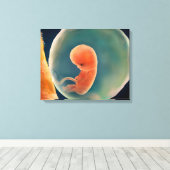 Ontwikkeling van de foetus op 9 weken canvas afdruk (Insitu (Houten vloer))