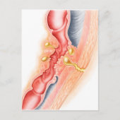 Ontwikkeling van fistels briefkaart (Voorkant)