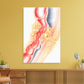 Ontwikkeling van fistels canvas afdruk (Insitu (Woonkamer))