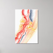 Ontwikkeling van fistels canvas afdruk (Voorkant)