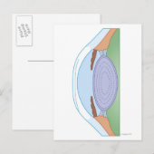 Oogaandoeningen Na corrigerende chirurgie Briefkaart (Voorkant / Achterkant)