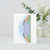 Oogaandoeningen Na corrigerende chirurgie Briefkaart (Staand voorkant)