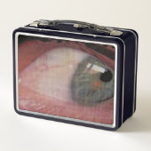 Oogbelasting (Achterkant)