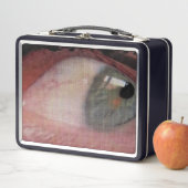 Oogbelasting (In situ)