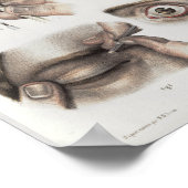 Oogchirurgie  Anatomie Afdrukken Poster (Hoek)