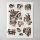 Oogchirurgie  Anatomie Afdrukken Poster (Voorkant)