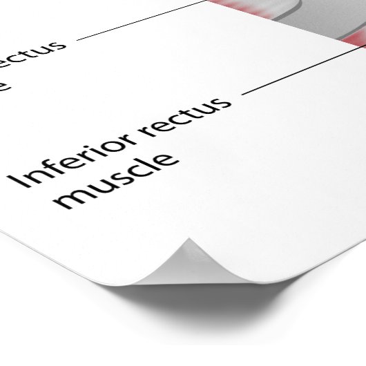 Oogconjunctiva anatomie Poster (Hoek)