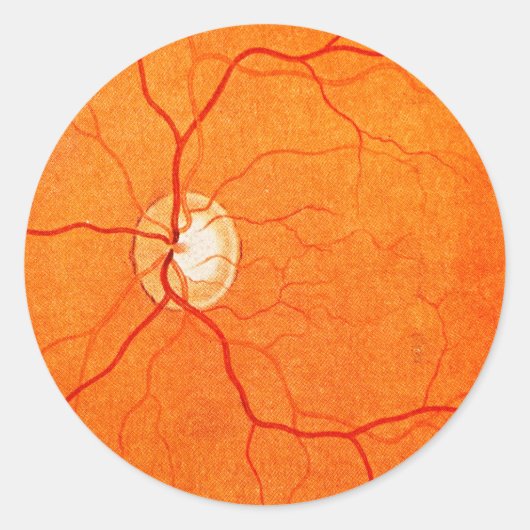 Oogheelkunde Optometrie Oogfundus Examen Sticker (Voorkant)