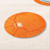 Oogheelkunde Optometrie Oogonderzoek Onderzetter m (Gebogen)