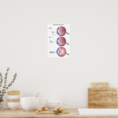 Oogziekte Glaucoom Poster (Keuken)