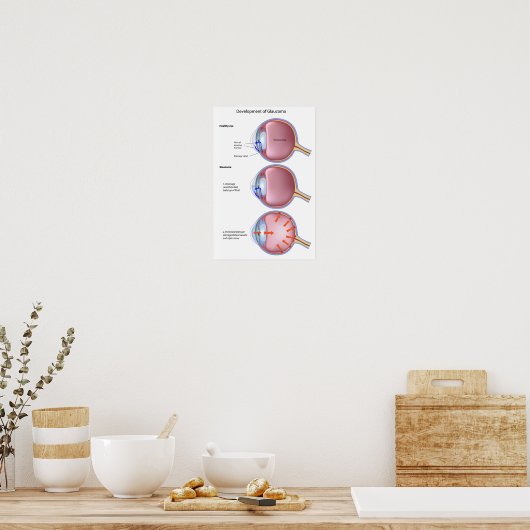 Oogziekte Glaucoom Poster (Keuken)