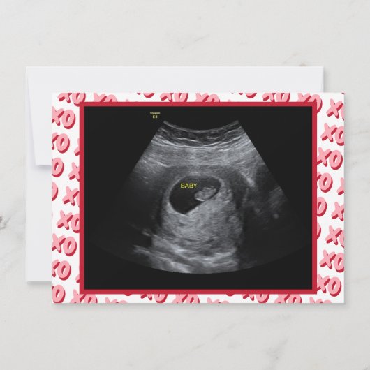 Opa Valentijns Ultrasound Zwangerschap Aankondiging (Achterkant)