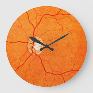 Ophthalmology Optometry Eye Fundus Exam Wall Clock Grote Klok