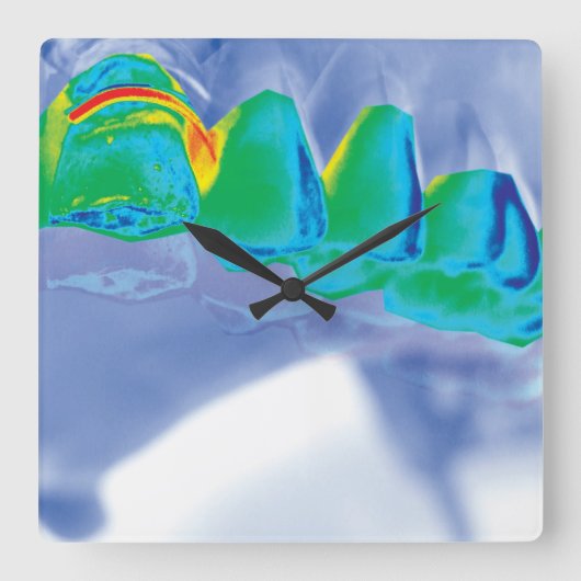 Originele tand van de Dentist Wall klok (Voorkant)