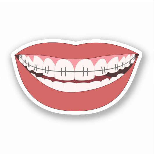 Orthodontisch glimlachapparaat sticker (Voorkant)