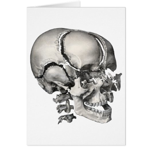 Oude wetenschap Menselijke anatomie, antieke sched (Voorkant)