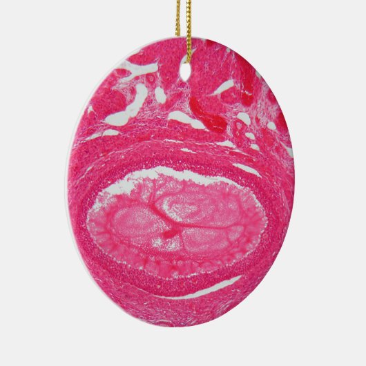 Ovariumcellen onder de microscoop. keramisch ornament (Rechts)