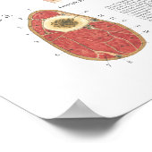 Paardenspierkramp Schouder Anatomie Grafiek Poster (Hoek)