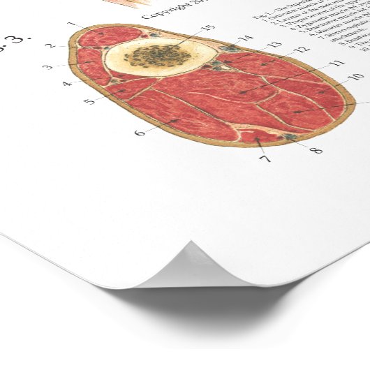 Paardenspierkramp Schouder Anatomie Grafiek Poster (Hoek)