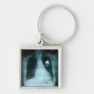 pacemaker xray sleutelhanger