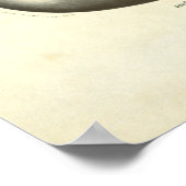  pancreas voor menselijke anatomie poster (Hoek)