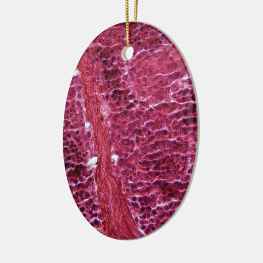 Pancreascellen onder de microscoop keramisch ornament (Links)