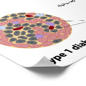 Pancreaseiland en Poster van diabetes (Hoek)