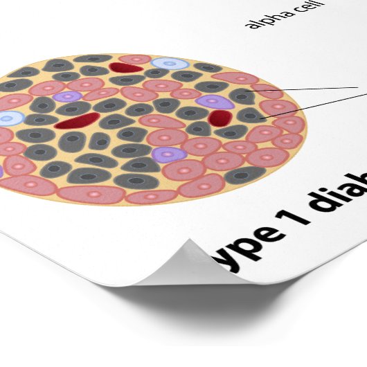 Pancreaseiland en Poster van diabetes (Hoek)