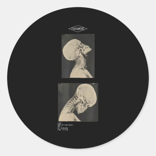 Paramore cropped headbanger röntgenartsen  ronde sticker (Voorkant)