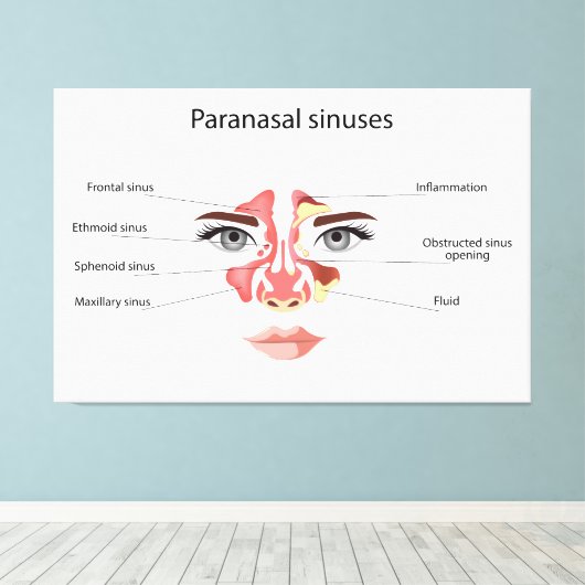 Paranasale sinussen canvas afdruk (Insitu (Houten vloer))