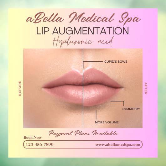 Pas MED Spa Lip Augmentatie Hyaluronic Fill aan Raamsticker (Vel 3)