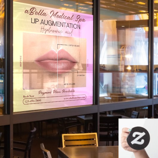 Pas MED Spa Lip Augmentatie Hyaluronic Fill aan Raamsticker (Restaurant Raam)