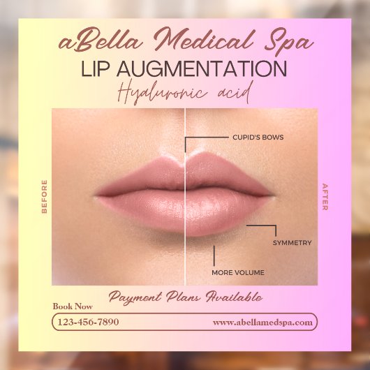Pas MED Spa Lip Augmentatie Hyaluronic Fill aan Raamsticker (Vel 2)