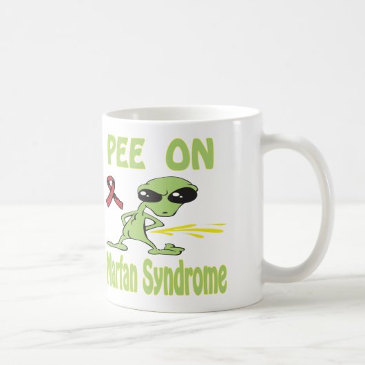Pee on Marfan Syndrome Mok (Rechts)