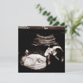 Persoonlijk Ultrasound Afbeelding Baby shower Kaart (Staand voorkant)