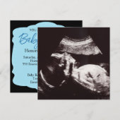 Persoonlijk Ultrasound Afbeelding Baby shower Kaart (Voorkant / Achterkant)